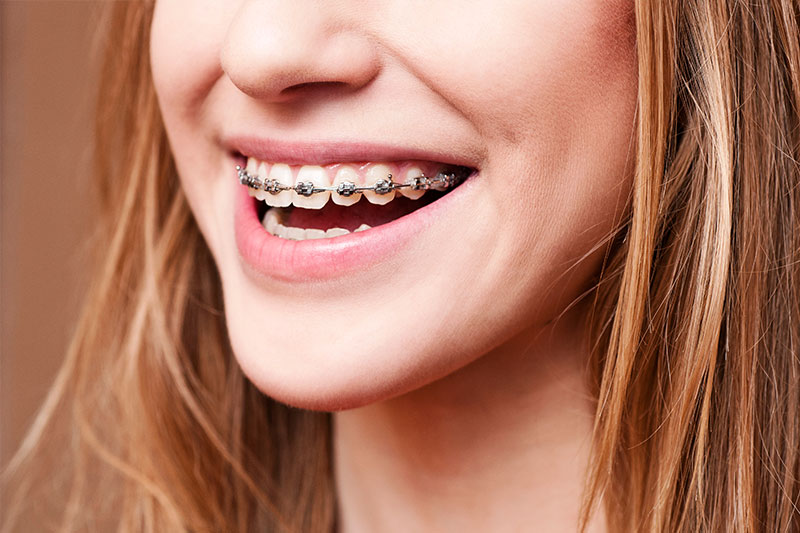Orthodontics in Phoenix