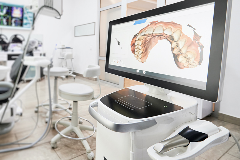 Intra-Oral Scanner in Phoenix