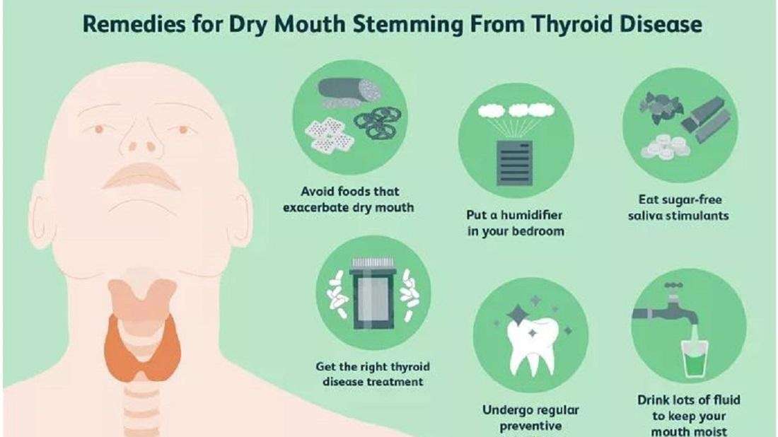 Hypothyroid and Dental Care Preventive Dentistry Phoenix AZ